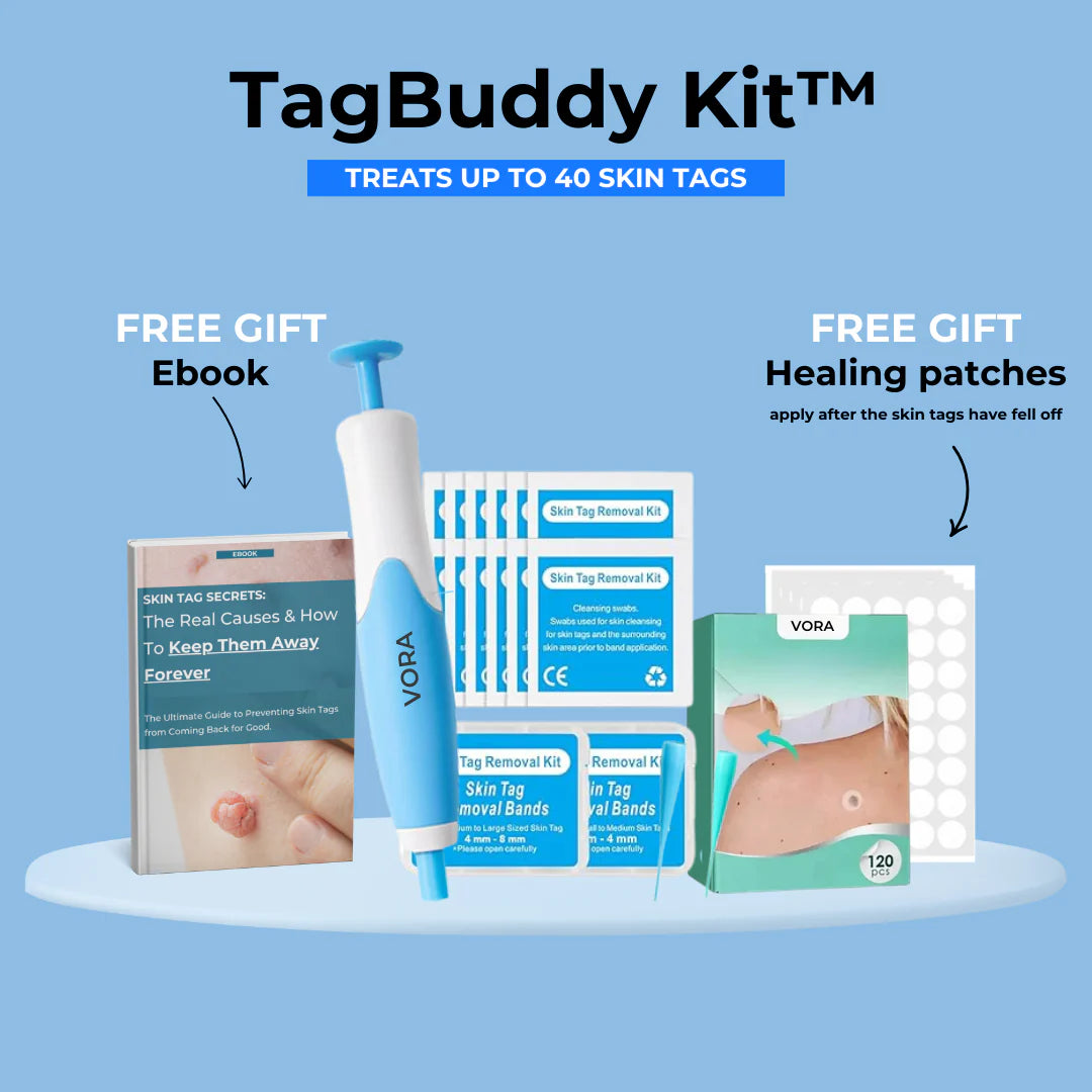 TagBuddy Kit™ Pro - No More Skin Tags - Today Only $19.95!
