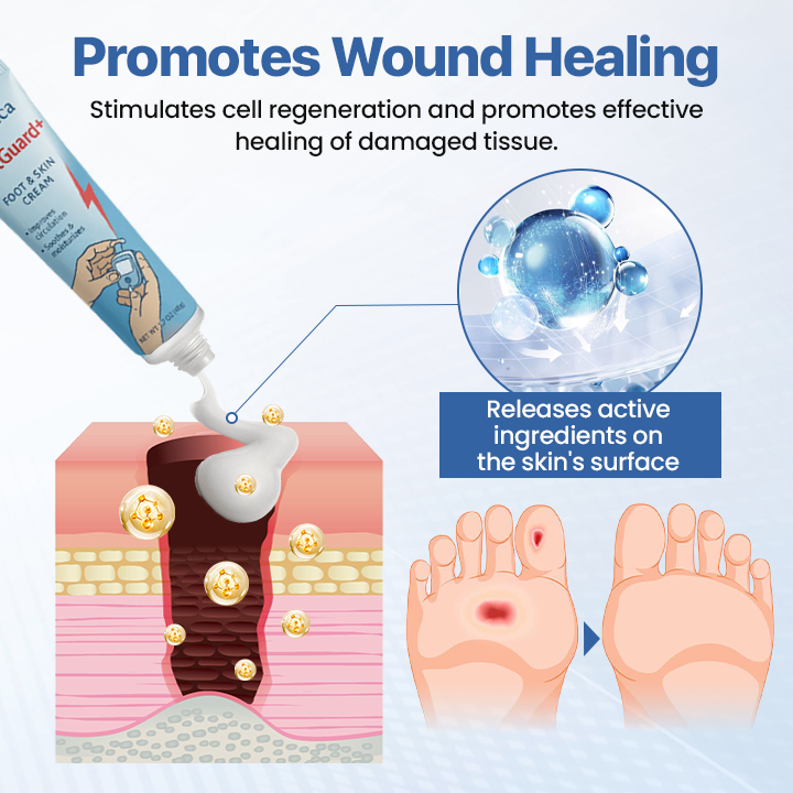 TYZIÖR FootGuard+ | Diabetes Treatment Cream