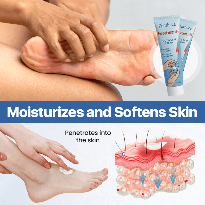 TYZIÖR FootGuard+ | Diabetes Treatment Cream