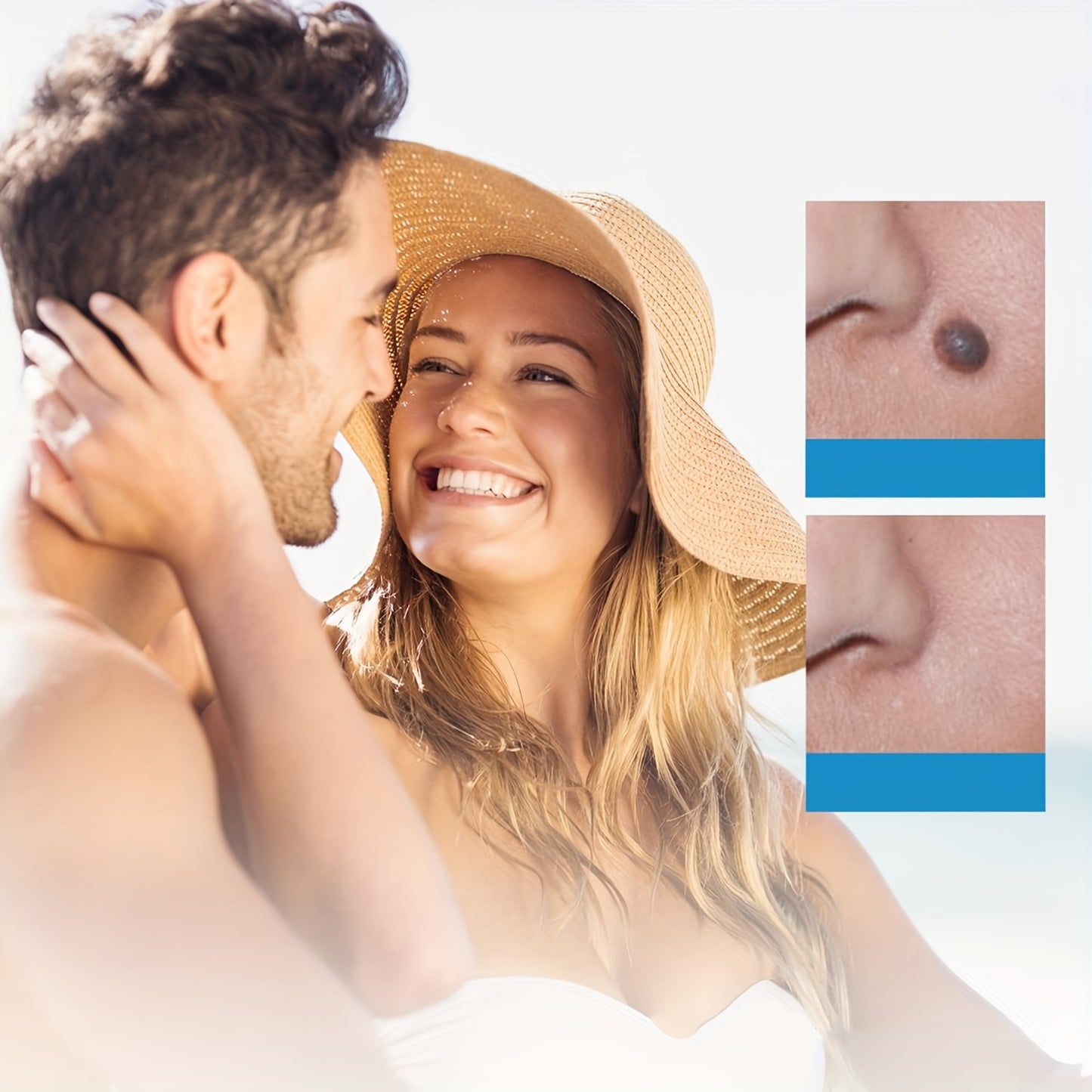 TagBuddy Kit™ Pro - No More Skin Tags - Today Only $19.95!