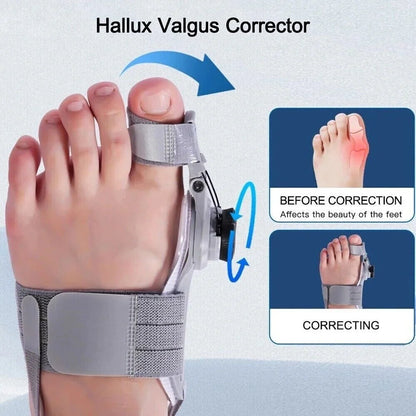 Original Treatmedy Bunion Fix - Only $24.95