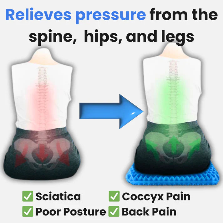 RejuvaSeat - Pain Relief Cushion - Only $19.95