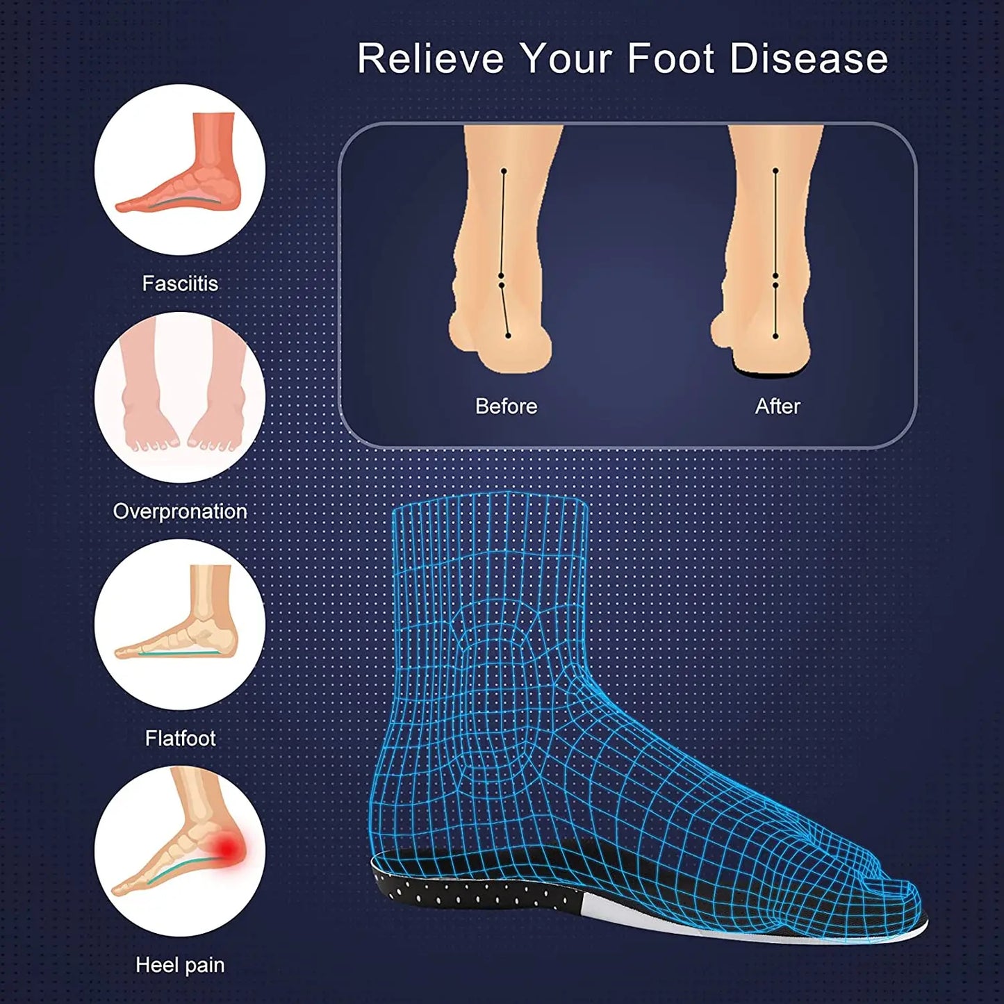 Plantar Pro Insoles - Only $14.95